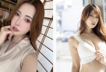 玩太凶受伤？波多野结衣胸前「变色」瘀青一大块 幸好神队友救援网哭爆-优优日报