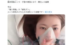 【速报】豊冈さつき(丰冈沙月)自爆罹患罕见疾病、可能致命! …-优优日报