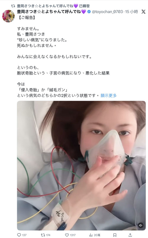 【速报】豊冈さつき(丰冈沙月)自爆罹患罕见疾病、可能致命! ...