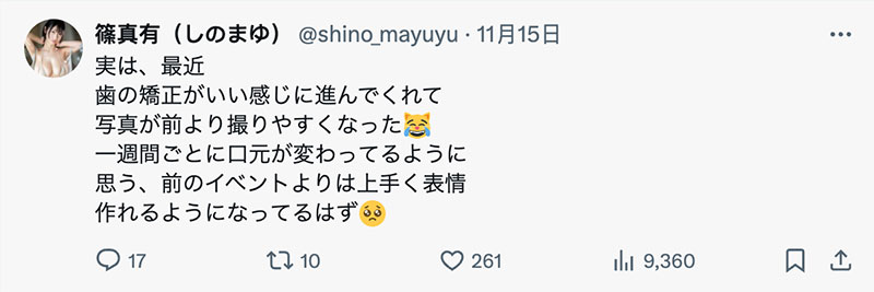 矫正牙齿中!史上最强隐藏巨乳、最细JCup的她要变性感女神? ...