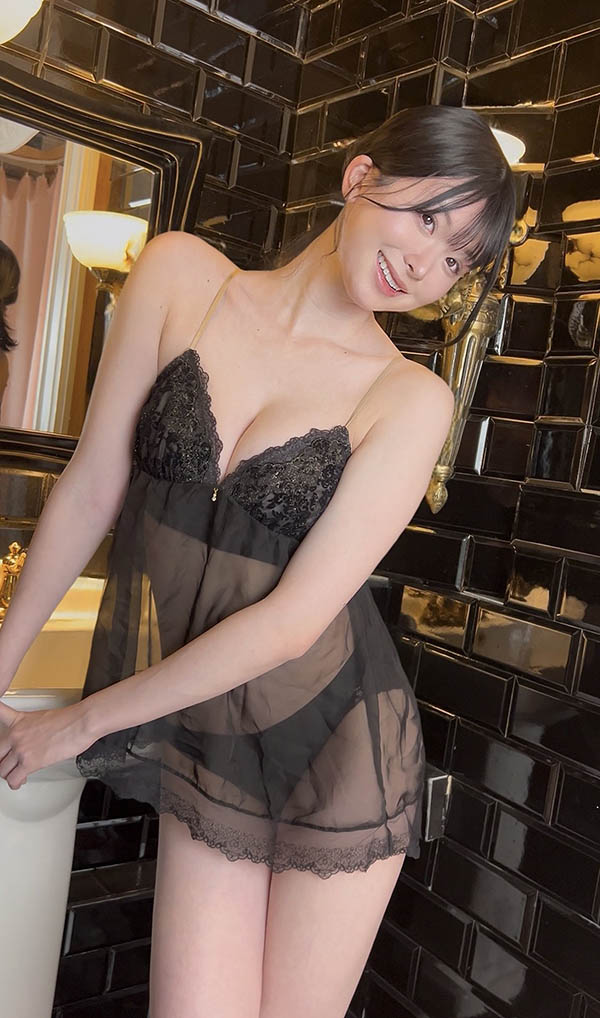 变成独眼龙!松本丽铃(原 明日见未来)被前男友打到受伤。