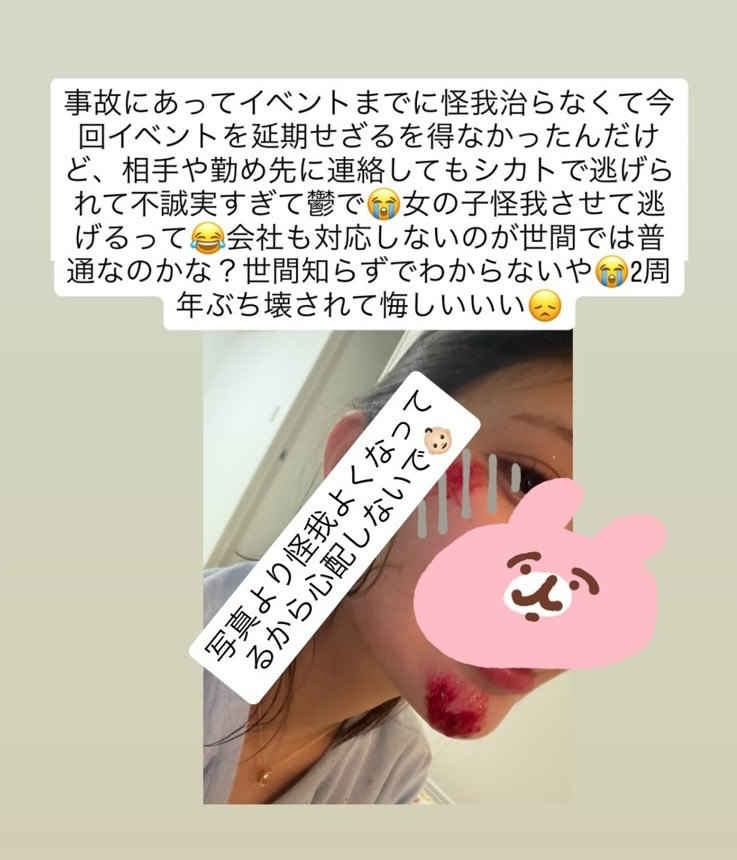 【速报】卷入事故被肇逃！仓木华受伤破相！