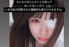 凉宫琴音:就算是这样,我也很努力地活着。-优优日报