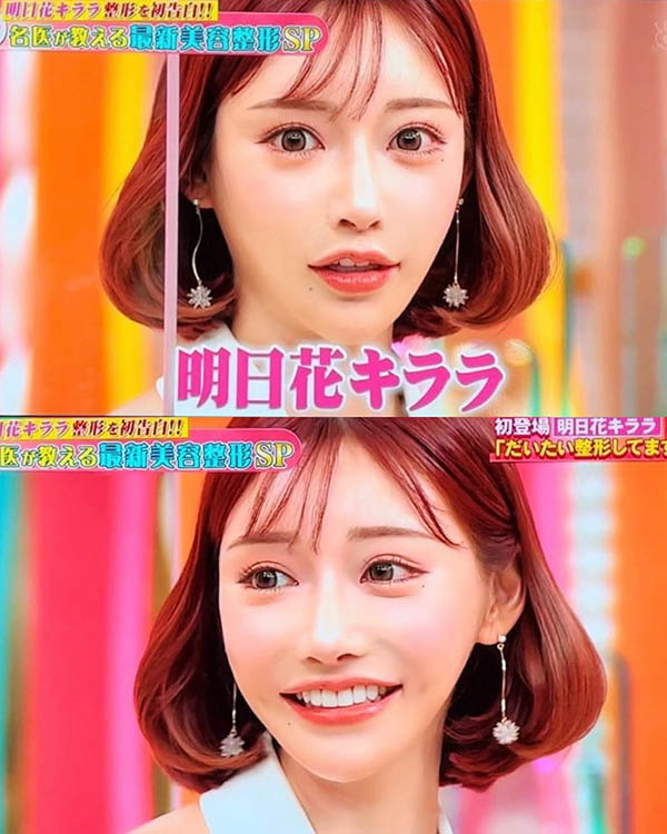 “明日花绮罗”首度承认全脸整形!但超完美“G罩杯豪乳”是纯天然性感曲线!